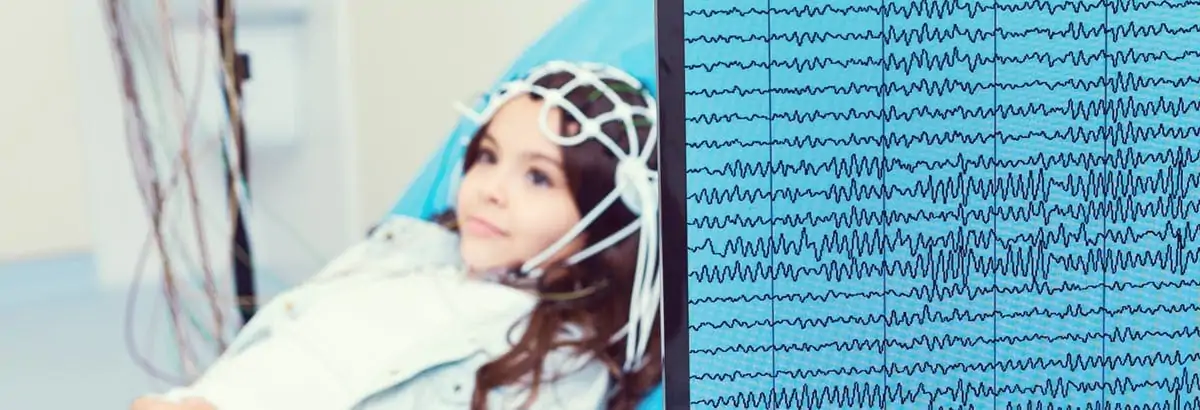 Hirnstrommessung EEG